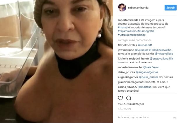 Cantora mostra os seios em rede social para alertar mulheres; veja vídeo